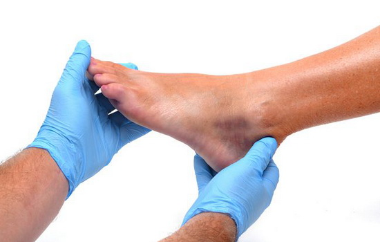 Констатация гиперемии при диагностике травмы мизинца на ноге