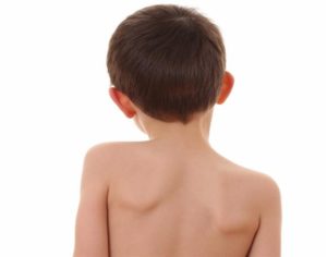Причины боли в спине у ребёнка