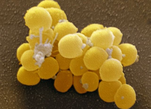 Золотистый стафилококк. St. aureus