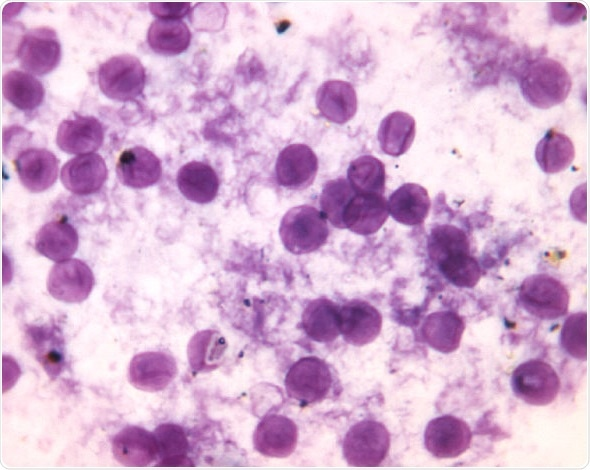 Pneumocystis Pneumonia – дрожжеподобный гриб