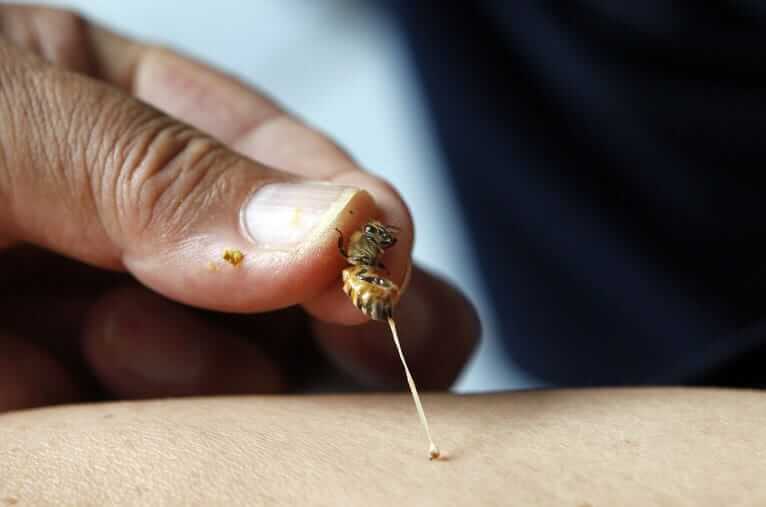 Лечение при помощи укусов пчёл