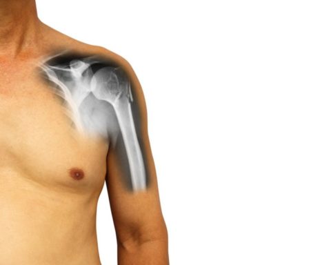 Анатомическая структура сустава плеча