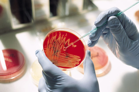 Бактериологический посев мокроты как метод определения туберкулеза.
