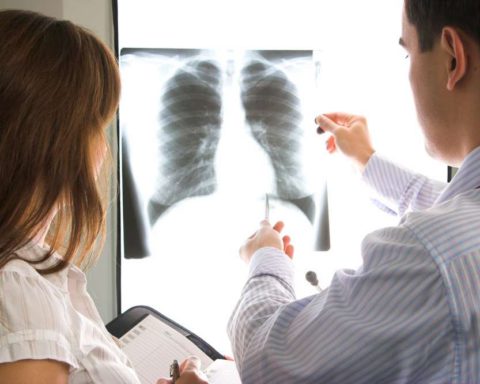 Четкие признаки пневмонии доступны врачу на рентгене.