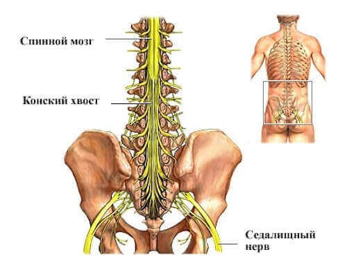 остеохондроз пояснично крестцового отдела позвоночника грыжевая форма