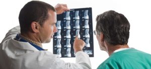Причины и лечение остеопороза у мужчин