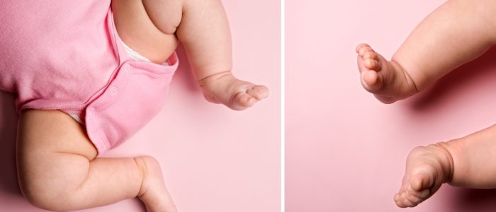 Угол тазобедренного сустава у грудных детей