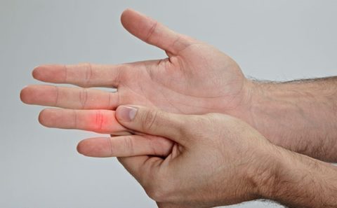 Эффективные способы восстановления целостности и функций после перелома пальца на руке