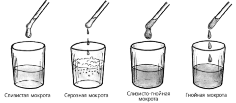Физические свойства мокроты в зависимости от состава