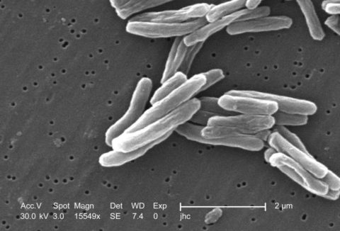 Фото палочки Коха (Mycobacterium tuberculosis) под микроскопом