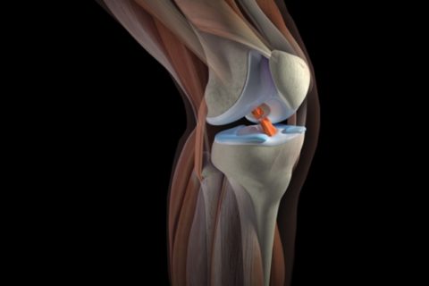Фото: распространенная симптоматика поврежденности коленного сустава в теле человека