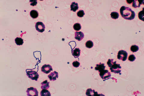 Фото streptococcus viridans под микроскопом