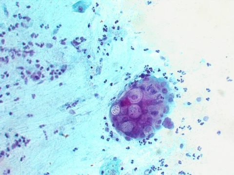 Хламидия под микроскопом