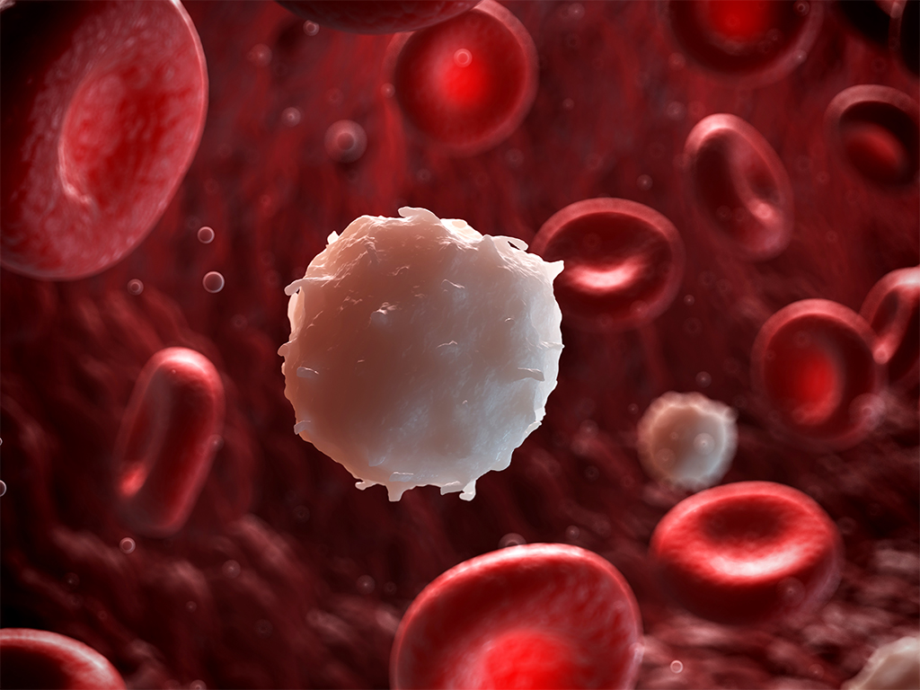 Изменение уровня лейкоцитов в крови – признак пневмонии