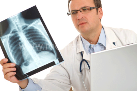Исключить вероятность развития пневмонии поможет рентгенография.