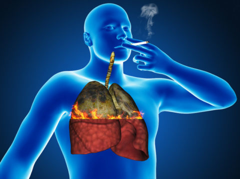 Как действует сигаретный дым на легкие и бронхи человека и почему при туберкулезе курить нельзя.