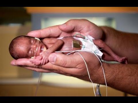 Как развивается пневмония у малышей?