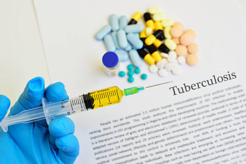 Кавернозный туберкулез – в чем особенность течения.