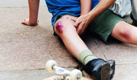 Классификация видов повреждений коленного сустава