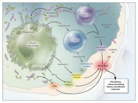Красочное представление патогенеза развития пневмонии.