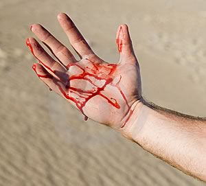 Кровь на руке