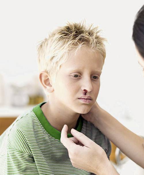 Травма носа: клиника перелома носа у детей, симптомы, диагностика, последствия не леченой травмы