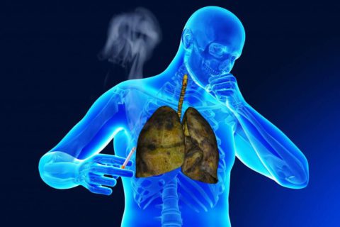 Курение как причина проявления пневмонии, бронхита и туберкулеза.