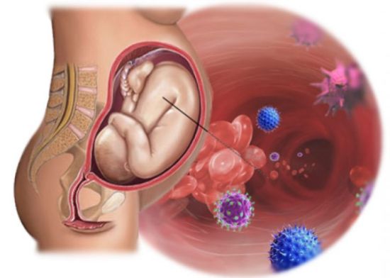 микоплазма при зачатии