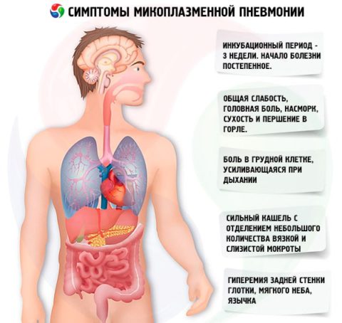 Микоплазменная пневмония (симптомы)