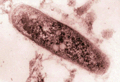 Mycobacterium tuberculosis (Палочка Коха)