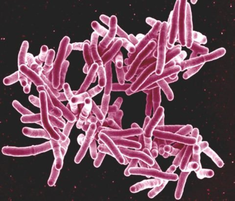 На фото туберкулезная микобактерия под большим увеличением
