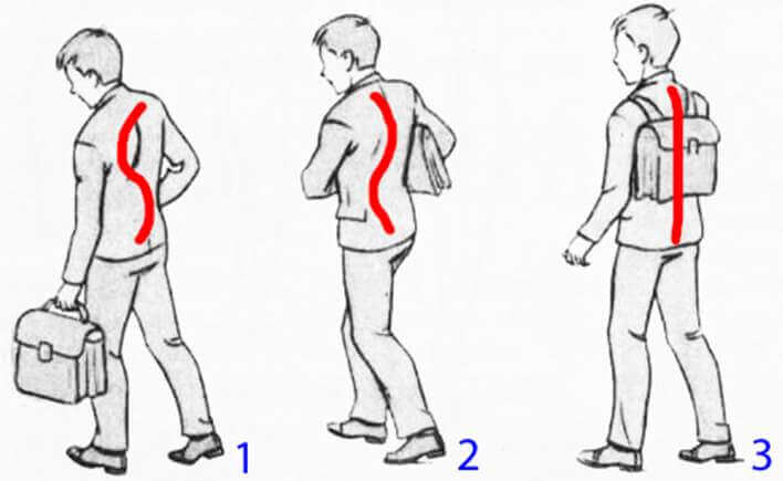 Как нарушается осанка при ношении рюкзака