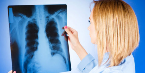 Один из самых информативных методов диагностики, рентгенография