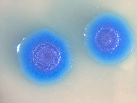 Окрашенные клетки микоплазмы