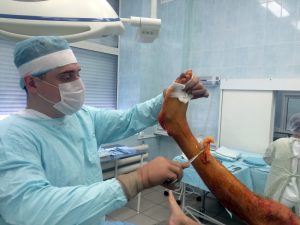 Переломы пальцев ног