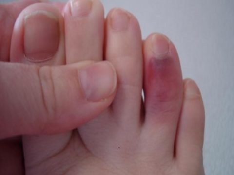 Особенности диагностики и первой медицинской помощи при травмах пальцев