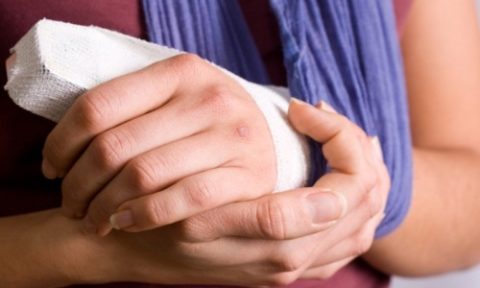 Особенности проведения закрытой репозиции сломанного пальца руки