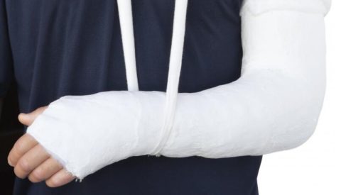 Особенности реабилитационных процедур для возобновления функциональности руки после перелома