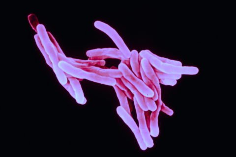 Палочка Коха — микобактерия, возбудитель туберкулеза
