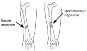 Акласта от остеопороза