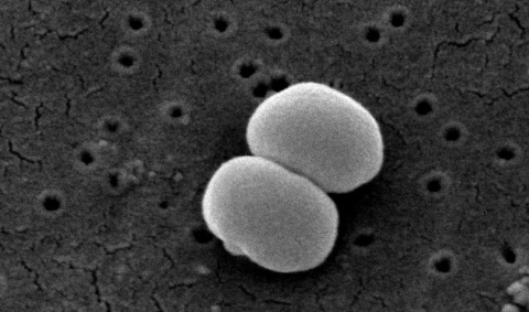 Пневмококк фото в бактерии под электронным микроскопом
