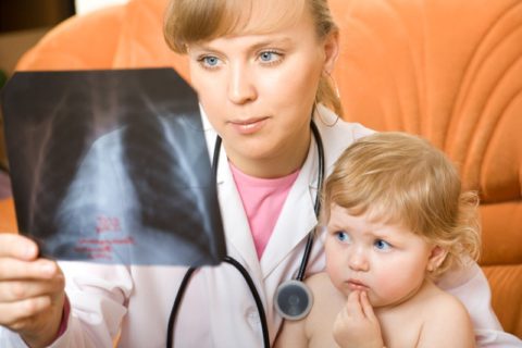 Пневмония требует обязательной госпитализации малыша