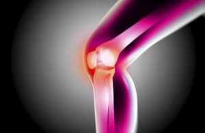 Разрыв связок сустава колена