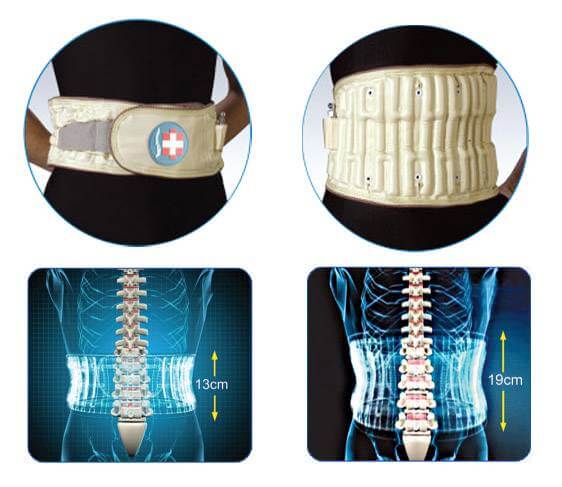Действие ортопедического пояса для спины