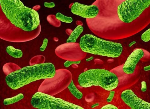 При бактериемии возникает множество гнойных очагов по всему организму