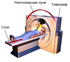 Магнитно-резонансная томография при остеохондрозе