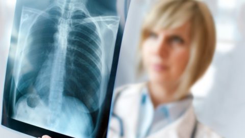 Рентген – самый верный способ диагностики