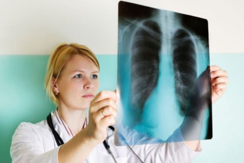 Рентгенография – наиболее информативный метод обследования.
