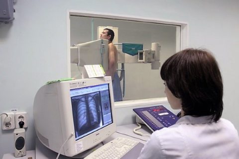 Рентгенография (флюорография) органов дыхания