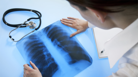 Рентгенография как метод диагностики.